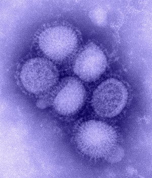 flu 
